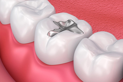 treatment image