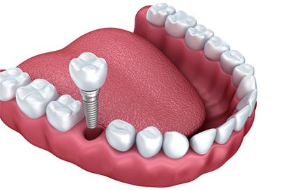 treatment image