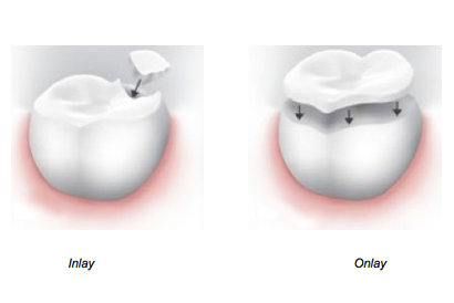 treatment image