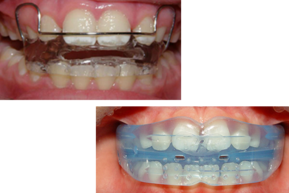 treatment image