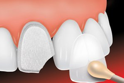 treatment image
