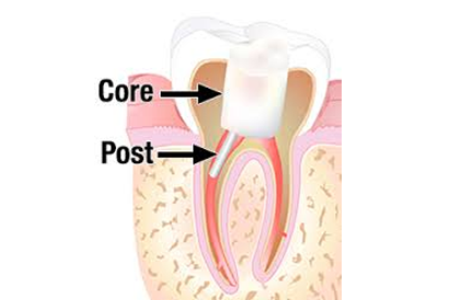 treatment image