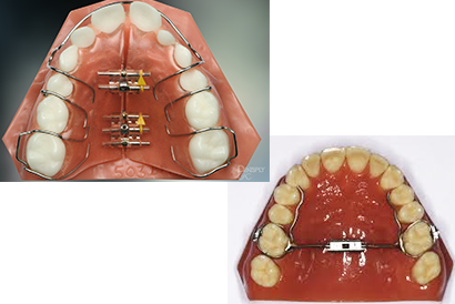 treatment image
