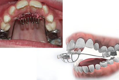 treatment image