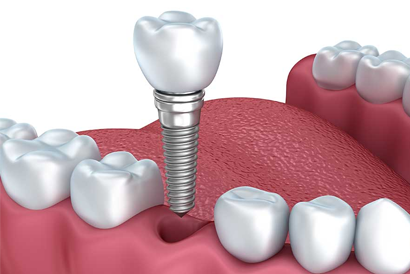 treatment image
