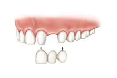 treatment image