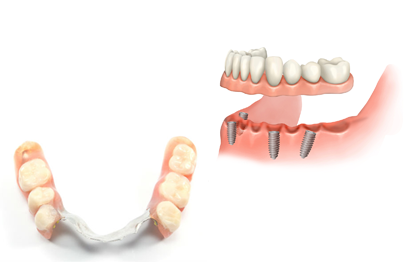 treatment image
