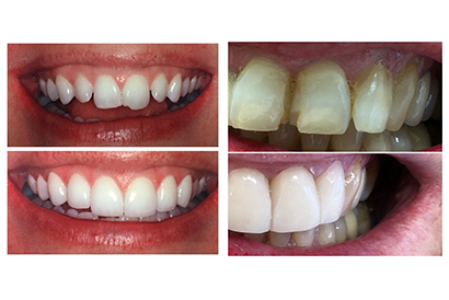 treatment image