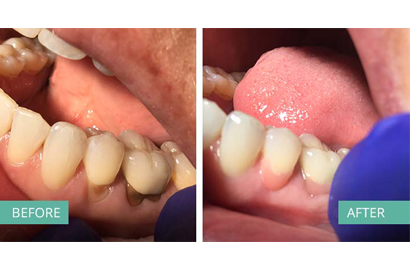 treatment image