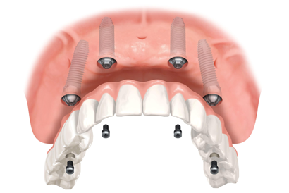 treatment image