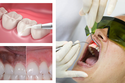 treatment image