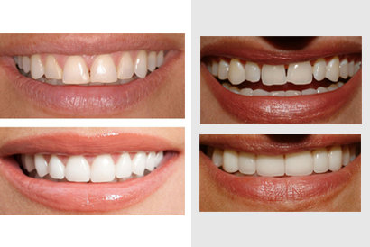 treatment image