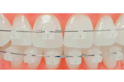 treatment image