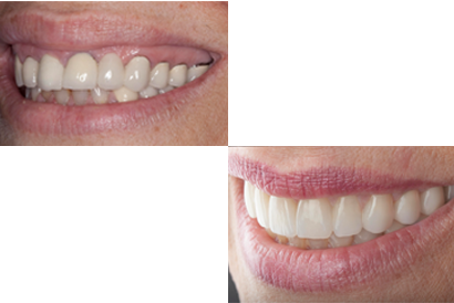 treatment image