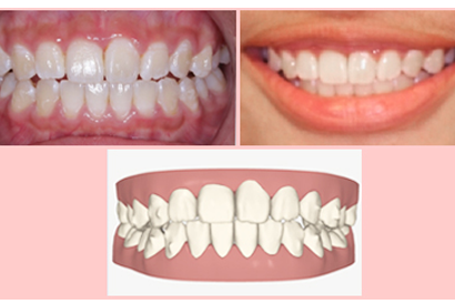 treatment image