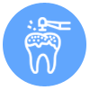 Drill less and painless Fillings